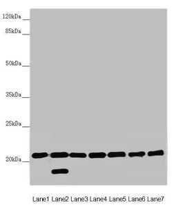 Western blot | All lanes: DCTN6 antibody at 3.03 μg/ml | Lane 1: Mouse lung tissue | Lane 2: Mouse gonadal tissue | Lane 3: A549 whole cell lysate | Lane 4: U251 whole cell lysate | Lane 5: Mouse thymus tissue | Lane 6: Rat brain tissue | Lane 7: Mouse stomach tissue | Secondary | Goat polyclonal to rabbit IgG at 1/10000 dilution | Predicted band size: 21 kDa | Observed band size: 21, 18 kDaRabbit anti-Human DCTN6 Polyclonal Antibody