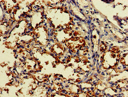 Immunohistochemistry of paraffin-embedded human lung tissue using the antibody at dilution of 1:100Rabbit anti-Human DDO Polyclonal Antibody