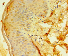 Immunohistochemistry of paraffin-embedded human skin tissue using DDX39A Antibody at dilution of 1:100Rabbit anti-Human DDX39A Polyclonal Antibody