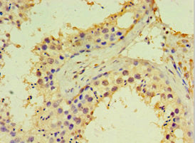Immunohistochemistry of paraffin-embedded human testis tissue using DDX39A Antibody at dilution of 1:100Rabbit anti-Human DDX39A Polyclonal Antibody