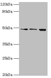 Western blot | All lanes: ATP-dependent RNA helicase DDX39A antibody at 2μg/ml | Lane 1: A431 whole cell lysate | Lane 2: 293T whole cell lysate | Lane 3: HepG2 whole cell lysate | Secondary | Goat polyclonal to rabbit IgG at 1/10000 dilution | Predicted band size: 50, 37, 31 kDa | Observed band size: 50 kDaRabbit anti-Human DDX39A Polyclonal Antibody