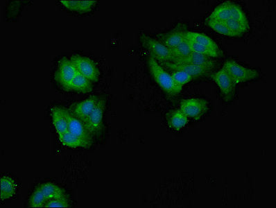 Immunofluorescent analysis of HepG2 cells using DDX3X Antibody at dilution of 1:100 and Alexa Fluor 488-congugated AffiniPure Goat Anti-Rabbit IgG(H+L)Rabbit anti-Human DDX3X Polyclonal Antibody