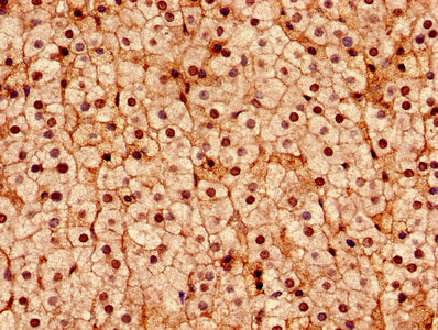 Immunohistochemistry analysis of human adrenal gland tissue using DDX3X Antibody at dilution of 1:100Rabbit anti-Human DDX3X Polyclonal Antibody