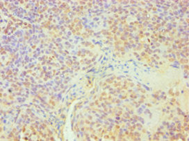 Immunohistochemistry of paraffin-embedded human tonsil tissue using DDX5 Antibody at dilution of 1:100Rabbit anti-Human DDX5 Polyclonal Antibody