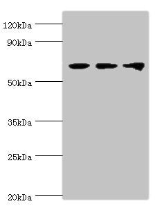 Western blot | All lanes: Probable ATP-dependent RNA helicase DDX5 antibody at 3μg/ml | Lane 1: NIH/3T3 whole cell lysate | Lane 2: Hela whole cell lysate | Lane 3: 293T whole cell lysate | Secondary | Goat polyclonal to rabbit IgG at 1/10000 dilution | Predicted band size: 70, 61 kDa | Observed band size: 70 kDaRabbit anti-Human DDX5 Polyclonal Antibody