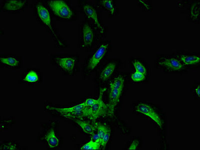 Immunofluorescent analysis of Hela cells using DDX6 Antibody at dilution of 1:100 and Alexa Fluor 488-congugated AffiniPure Goat Anti-Rabbit IgG(H+L)Rabbit anti-Human DDX6 Polyclonal Antibody