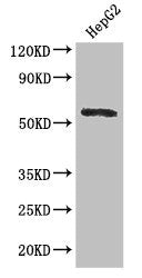 Western Blot  | Positive WB detected in: HepG2 whole cell lysate  | All lanes: DDX6 antibody at 2.8µg/ml  | Secondary  | Goat polyclonal to rabbit IgG at 1/50000 dilution  | Predicted band size: 55 kDa  | Observed band size: 55 kDaRabbit anti-Human DDX6 Polyclonal Antibody