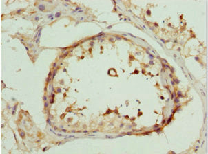 Immunohistochemistry of paraffin-embedded human testis tissue using DEDD Antibody at dilution of 1:100