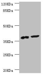 Western blot | All lanes: DEDD antibody at 0.56μg/ml | Lane 1: Mouse lung tissue | Lane 2: Mouse thymus tissue | Secondary | Goat polyclonal to rabbit IgG at 1/10000 dilution | Predicted band size: 37, 41 kDa | Observed band size: 37 kDa