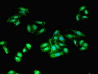 Immunofluorescent analysis of HepG2 cells using AIF1 Antibody at dilution of 1:100 and Alexa Fluor 488-congugated AffiniPure Goat Anti-Rabbit IgG(H+L)Rabbit anti-Human AIF1 Polyclonal Antibody