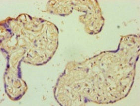 Immunohistochemistry of paraffin-embedded human placenta tissue using the antibody at dilution of 1:100Rabbit anti-Human AIF1 Polyclonal Antibody