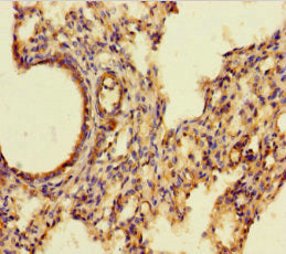 Immunohistochemistry of paraffin-embedded human lung tissue using AIF1 Antibody at dilution of 1:100Rabbit anti-Human AIF1 Polyclonal Antibody