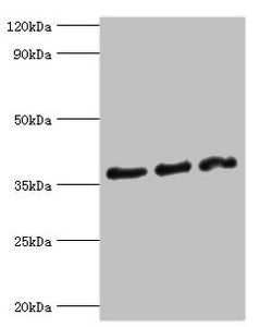 Western blot | All lanes: DFFA antibody at 10μg/ml | Lane 1: Hela whole cell lysate | Lane 2: 293T whole cell lysate | Lane 3: PC-3 whole cell lysate | Secondary | Goat polyclonal to rabbit IgG at 1/10000 dilution | Predicted band size: 37, 30 kDa | Observed band size: 37 kDaRabbit anti-Human DFFA Polyclonal Antibody