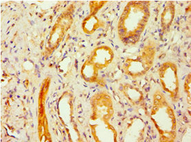 Immunohistochemistry of paraffin-embedded human kidney tissue using GSDME Antibody at dilution of 1:100Rabbit anti-Human GSDME Polyclonal Antibody