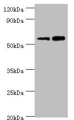 Western blot | All lanes: Non-syndromic hearing impairment protein 5 antibody at 10μg/ml | Lane 1: Hela whole cell lysate | Lane 2: HepG2 whole cell lysate | Secondary | Goat polyclonal to rabbit IgG at 1/10000 dilution | Predicted band size: 55, 11, 37 kDa | Observed band size: 55 kDaRabbit anti-Human GSDME Polyclonal Antibody