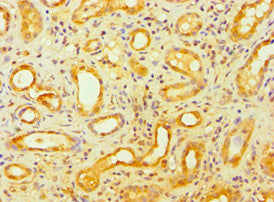 Immunohistochemistry of paraffin-embedded human kidney tissue using GSDME Antibody at dilution of 1:100Rabbit anti-Human GSDME Polyclonal Antibody