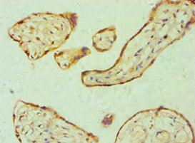Immunohistochemistry of paraffin-embedded human placenta tissue using GSDME Antibody at dilution of 1:100Rabbit anti-Human GSDME Polyclonal Antibody