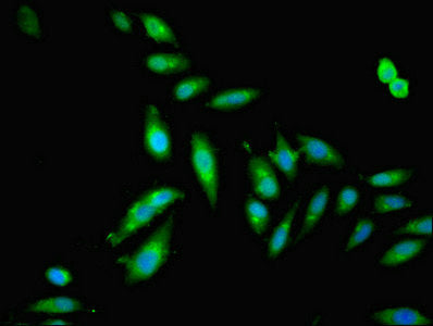 Immunofluorescent analysis of Hela cells using GSDME Antibody at dilution of 1:100 and Alexa Fluor 488-congugated AffiniPure Goat Anti-Rabbit IgG(H+L)Rabbit anti-Human GSDME Polyclonal Antibody