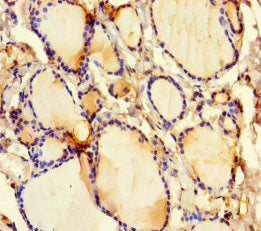 Immunohistochemistry of paraffin-embedded human thyroid tissue using the antibody at dilution of 1:100Rabbit anti-Human GSDME Polyclonal Antibody
