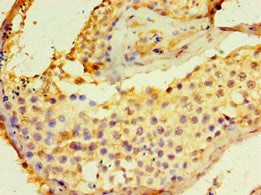 Immunohistochemistry of paraffin-embedded human testis tissue using DGKE Antibody at dilution of 1:100