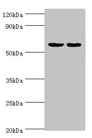 Western blot | All lanes: Diacylglycerol kinase epsilon antibody at 5μg/ml | Lane 1: Rat brain tissue | Lane 2: Hela whole cell lysate | Secondary | Goat polyclonal to rabbit IgG at 1/10000 dilution | Predicted band size: 64, 21 kDa | Observed band size: 64 kDa
