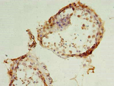 Immunohistochemistry of paraffin-embedded human testis tissue using DHRS12 Antibody at dilution of 1:100Rabbit anti-Human DHRS12 Polyclonal Antibody