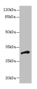 Western blot  | All lanes: DHRS12 antibody at 1.3µg/ml + Human placenta tissue  | Secondary  | Goat polyclonal to rabbit IgG at 1/10000 dilution  | Predicted band size: 36, 28, 31 kDa  | Observed band size: 31 kDaRabbit anti-Human DHRS12 Polyclonal Antibody
