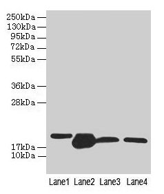 Western blot  | All lanes: DHRS3 antibody at 0.8µg/ml  | Lane 1: A375 whole cell lysate  | Lane 2: Mouse liver tissue  | Lane 3: Mouse spleen tissue  | Lane 4: HL60 whole cell lysate  | Secondary  | Goat polyclonal to rabbit IgG at 1/10000 dilution  | Predicted band size: 34, 19 kDa  | Observed band size: 19 kDaRabbit anti-Human DHRS3 Polyclonal Antibody