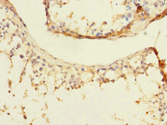 Immunohistochemistry of paraffin-embedded human testis tissue using DIAPH2 Antibody at dilution of 1:100Rabbit anti-Human DIAPH2 Polyclonal Antibody