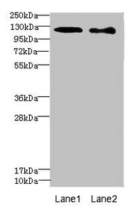 Western blot | All lanes: DIAPH2 antibody at 4.75μg/ml | Lane 1: 293T whole cell lysate | Lane 2: Hela whole cell lysate | Secondary | Goat polyclonal to rabbit IgG at 1/10000 dilution | Predicted band size: 126, 125 kDa | Observed band size: 126 kDaRabbit anti-Human DIAPH2 Polyclonal Antibody