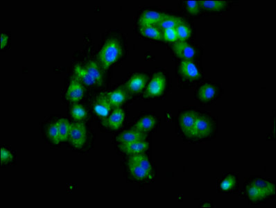 Immunofluorescence staining of HepG2 cells with DLK1 Antibody at 1:100, counter-stained with DAPI. The cells were fixed in 4% formaldehyde, permeabilized using 0.2% Triton X-100 and blocked in 10% normal Goat Serum. The cells were then incubated with the antibody overnight at 4°C. The secondary antibody was Alexa Fluor 488-congugated AffiniPure Goat Anti-Rabbit IgG(H+L).Rabbit anti-Human DLK1 Polyclonal Antibody