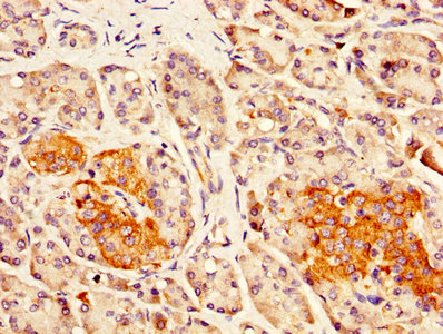 IHC image of DLK1 Antibody diluted at 1:300 and staining in paraffin-embedded human pancreatic tissue performed on a Leica BondTM system. After dewaxing and hydration, antigen retrieval was mediated by high pressure in a citrate buffer (pH 6.0). Section was blocked with 10% normal goat serum 30min at RT. Then primary antibody (1% BSA) was incubated at 4°C overnight. The primary is detected by a biotinylated secondary antibody and visualized using an HRP conjugated SP system.Rabbit anti-Human DLK1 Polyclonal Antibody