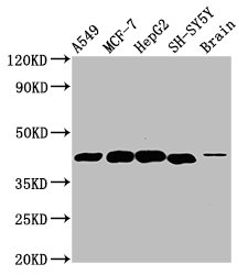 Western Blot  | Positive WB detected in: A549 whole cell lysate, MCF-7 whole cell lysate, HepG2 whole cell lysate, SH-SY5Y whole cell lysate, Rat brain tissue  | All lanes: DLK1 antibody at 4.6µg/ml  | Secondary  | Goat polyclonal to rabbit IgG at 1/50000 dilution  | Predicted band size: 42, 34 kDa  | Observed band size: 42 kDaRabbit anti-Human DLK1 Polyclonal Antibody