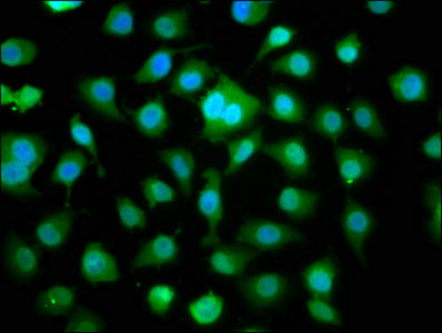 Immunofluorescence staining of A549 cells with DMPK Antibody at 1:166, counter-stained with DAPI. The cells were fixed in 4% formaldehyde, permeabilized using 0.2% Triton X-100 and blocked in 10% normal Goat Serum. The cells were then incubated with the antibody overnight at 4°C. The secondary antibody was Alexa Fluor 488-congugated AffiniPure Goat Anti-Rabbit IgG(H+L).Rabbit anti-Human DMPK Polyclonal Antibody