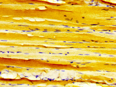 IHC image of the antibody diluted at 1:500 and staining in paraffin-embedded human skeletal muscle tissue performed on a Leica BondTM system. After dewaxing and hydration, antigen retrieval was mediated by high pressure in a citrate buffer (pH 6.0). Section was blocked with 10% normal goat serum 30min at RT. Then primary antibody (1% BSA) was incubated at 4°C overnight. The primary is detected by a biotinylated secondary antibody and visualized using an HRP conjugated SP system.Rabbit anti-Human DMPK Polyclonal Antibody