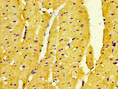 IHC image of DMPK Antibody diluted at 1:500 and staining in paraffin-embedded human heart tissue performed on a Leica BondTM system. After dewaxing and hydration, antigen retrieval was mediated by high pressure in a citrate buffer (pH 6.0). Section was blocked with 10% normal goat serum 30min at RT. Then primary antibody (1% BSA) was incubated at 4°C overnight. The primary is detected by a biotinylated secondary antibody and visualized using an HRP conjugated SP system.Rabbit anti-Human DMPK Polyclonal Antibody