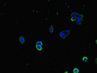 Immunofluorescence staining of HepG2 cells with DNAJA1 Antibody at 1:333, counter-stained with DAPI. The cells were fixed in 4% formaldehyde, permeabilized using 0.2% Triton X-100 and blocked in 10% normal Goat Serum. The cells were then incubated with the antibody overnight at 4°C. The secondary antibody was Alexa Fluor 488-congugated AffiniPure Goat Anti-Rabbit IgG(H+L).Rabbit anti-Human DNAJA1 Polyclonal Antibody