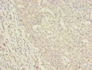 Immunohistochemistry of paraffin-embedded human tonsil tissue using DNAJA2 Antibody at dilution of 1:100Rabbit anti-Human DNAJA2 Polyclonal Antibody