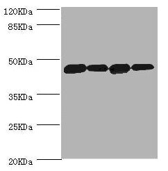 Western blot  | All lanes: DNAJA2 antibody at 3.12μg/ml  | Lane 1: A375 whole cell lysate  | Lane 2: PC-3 whole cell lysate  | Lane 3: HepG2 whole cell lysate  | Lane 4: Hela whole cell lysate  | Secondary  | Goat polyclonal to rabbit IgG at 1/10000 dilution  | Predicted band size: 46 kDa  | Observed band size: 46 kDaRabbit anti-Human DNAJA2 Polyclonal Antibody