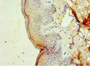 Immunohistochemistry of paraffin-embedded human skin tissue using DNAJB2 Antibody at dilution of 1:100Rabbit anti-Human DNAJB2 Polyclonal Antibody