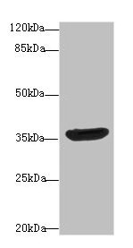 Western blot  | All lanes: DNAJB2 antibody at 10µg/ml + A431 whole cell lysate  | Secondary  | Goat polyclonal to rabbit IgG at 1/10000 dilution  | Predicted band size: 36, 31 kDa  | Observed band size: 36 kDaRabbit anti-Human DNAJB2 Polyclonal Antibody