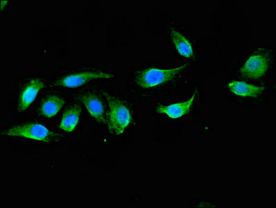 Immunofluorescent analysis of A549 cells using DOK3 Antibody at dilution of 1:100 and Alexa Fluor 488-congugated AffiniPure Goat Anti-Rabbit IgG(H+L)Rabbit anti-Human DOK3 Polyclonal Antibody