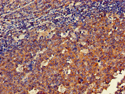 Immunohistochemistry of paraffin-embedded human tonsil tissue using DOK3 Antibody at dilution of 1:100Rabbit anti-Human DOK3 Polyclonal Antibody