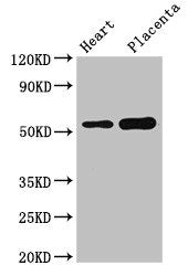 Western Blot  | Positive WB detected in: Mouse heart tissue, Human placenta tissue  | All lanes: DOK3 antibody at 3µg/ml  | Secondary  | Goat polyclonal to rabbit IgG at 1/50000 dilution  | Predicted band size: 54, 24, 36, 25 kDa  | Observed band size: 54 kDaRabbit anti-Human DOK3 Polyclonal Antibody