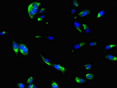 Immunofluorescent analysis of Hela cells using DNAJC6 Antibody at dilution of 1:100 and Alexa Fluor 488-congugated AffiniPure Goat Anti-Rabbit IgG(H+L)