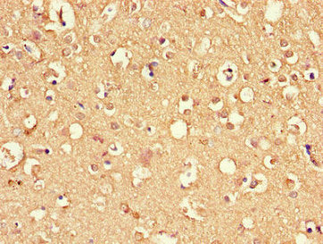 Immunohistochemistry of paraffin-embedded human brain tissue using the antibody at dilution of 1:100