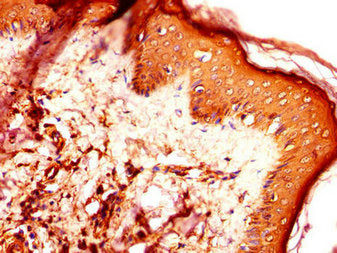 Immunohistochemistry of paraffin-embedded human skin tissue using DNAJC6 Antibody at dilution of 1:100