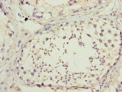 Immunohistochemistry of paraffin-embedded human testis tissue using DNAL4 Antibody at dilution of 1:100Rabbit anti-Human DNAL4 Polyclonal Antibody