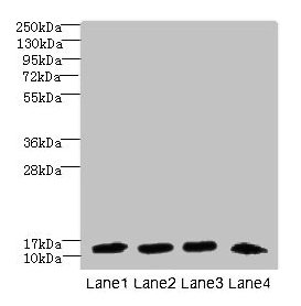 Western blot  | All lanes: DNAL4 antibody at 1.5µg/ml  | Lane 1: Mouse gonadal tissue  | Lane 2: HL60 whole cell lysate  | Lane 3: NIH/3T3 whole cell lysate  | Lane 4: Mouse brain tissue  | Secondary  | Goat polyclonal to rabbit IgG at 1/10000 dilution  | Predicted band size: 13 kDa  | Observed band size: 13 kDaRabbit anti-Human DNAL4 Polyclonal Antibody