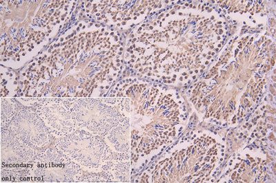 Immunohistochemistry of paraffin-embedded human testis tissue using DNALI1 Antibody at dilution of 1:100Rabbit anti-Human DNALI1 Polyclonal Antibody